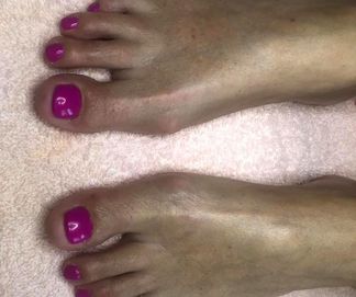 purple toes